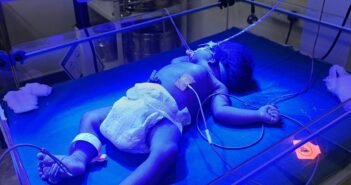 குழந்தைகளைத் தாக்கும் மஞ்சள் காமாலை… சந்தேகங்களும் தீர்வுகளும் | பச்சிளம் குழந்தை பராமரிப்பு – 1 | Infant Care – Jaundice attacks children!