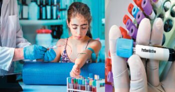 ரத்தக்கசிவைத் தடுக்கும் தட்டணுக்கள்!