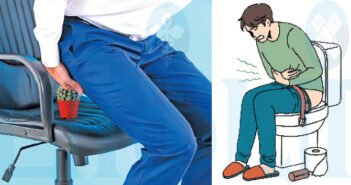 மூலத்தைப் போக்கும் காரநூல் சிகிச்சை!