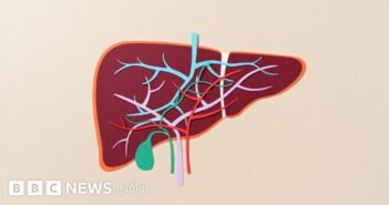 “மிரட்டி பெறப்பட்ட கல்லீரல் தானம்”- நாமக்கல் பெண்ணின் புகாரால் அதிர்ச்சி