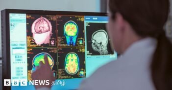 அதீத நினைவுத் திறன்; வரமா சாபமா? – உங்களுக்கு இந்த அறிகுறிகள் உள்ளதா?