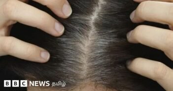 இளநரை வராமல் தவிர்ப்பது எப்படி? ஒரு நரைமுடியை பிடுங்கினால் அதிக வெள்ளை முடி வருமா?